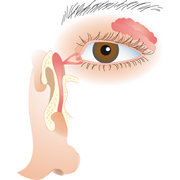 aanvoer&nbsp;en&nbsp;afvoer&nbsp;van&nbsp;traanvocht