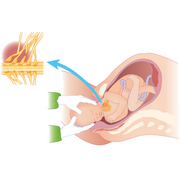 plexus&nbsp;brachialis