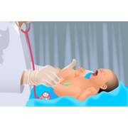 baby&nbsp;wordt&nbsp;getest&nbsp;vlak&nbsp;na&nbsp;de&nbsp;geboorte